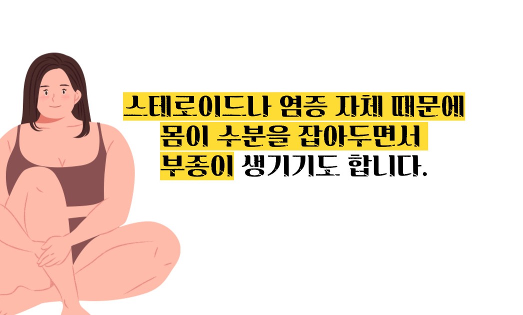루푸스병 이란