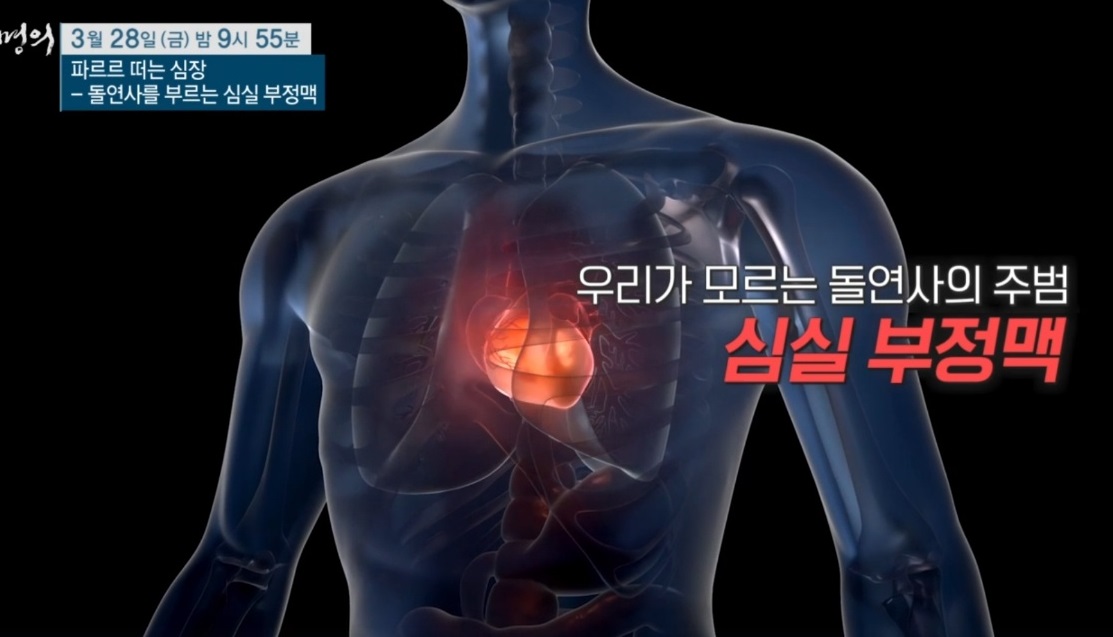 심실부정맥-박경민-교수