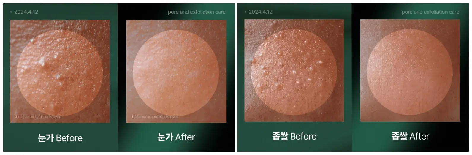 율작 율무크림 효과