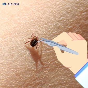 진드기 물린자국 대처법 참진드기 빨간 진드기 증상 확인_17