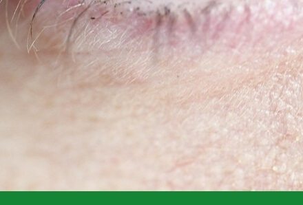 눈건강지키는법