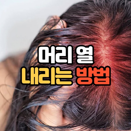 머리 열 내리는 방법