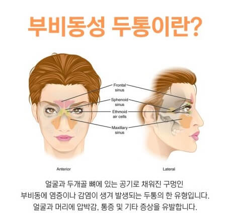 코골이의 증상