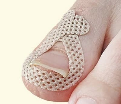 살에붙이는밴드