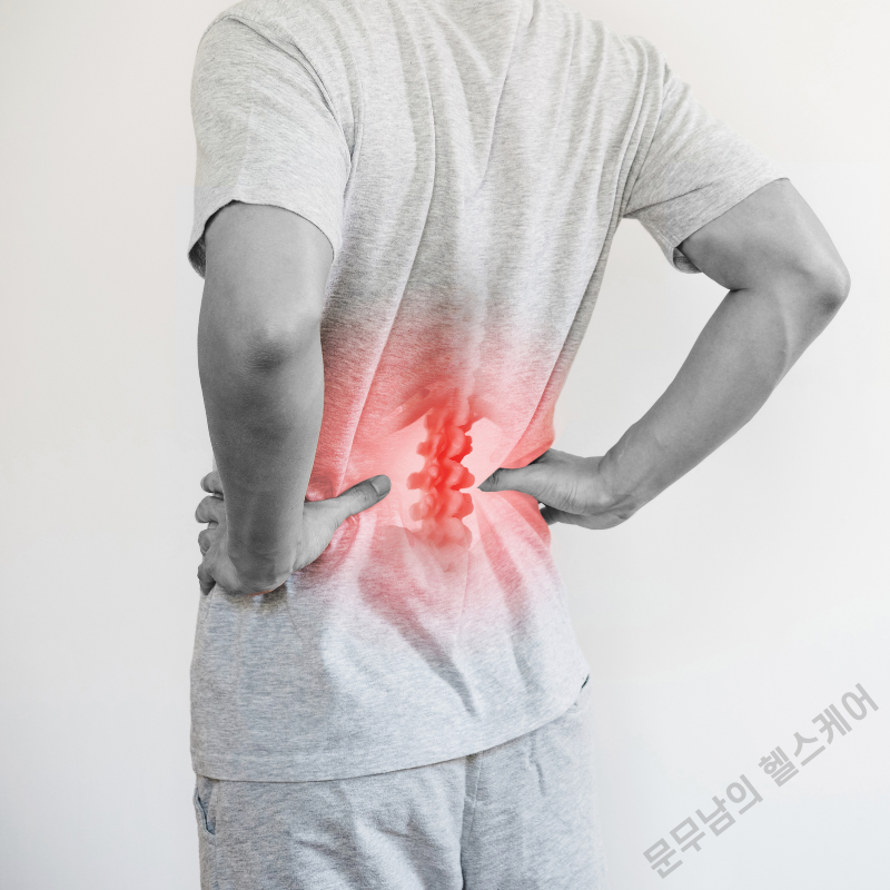 허리통증 원인 4가지