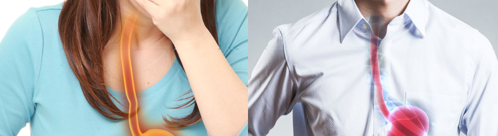 역류성 식도염2