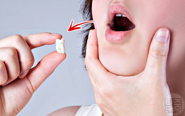 스트레스 받으면 이빨 흔들리는 이유,스트레스 잇몸 부음 이시림 출혈