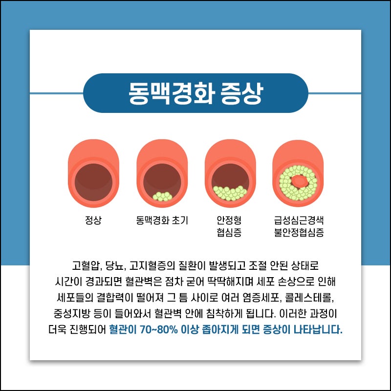 고지혈증 수치 기준, 정상이라고 안심하면 위험한 이유