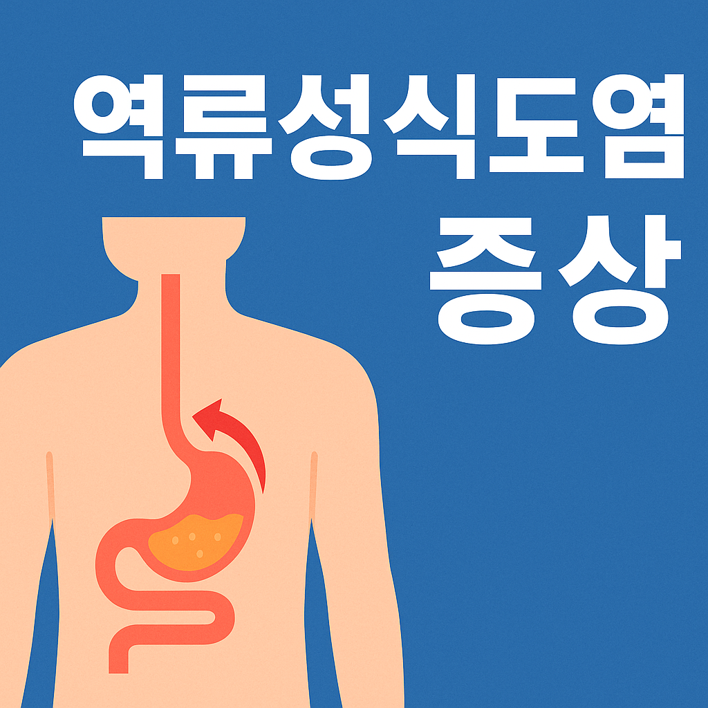 역류성식도염 증상