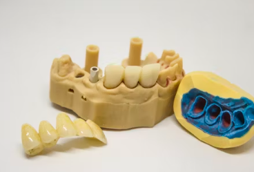 라이나생명 치아보험 청구서류 해지 보장내용