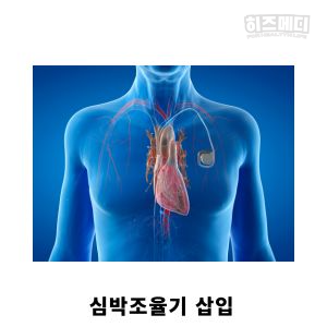 동성서맥