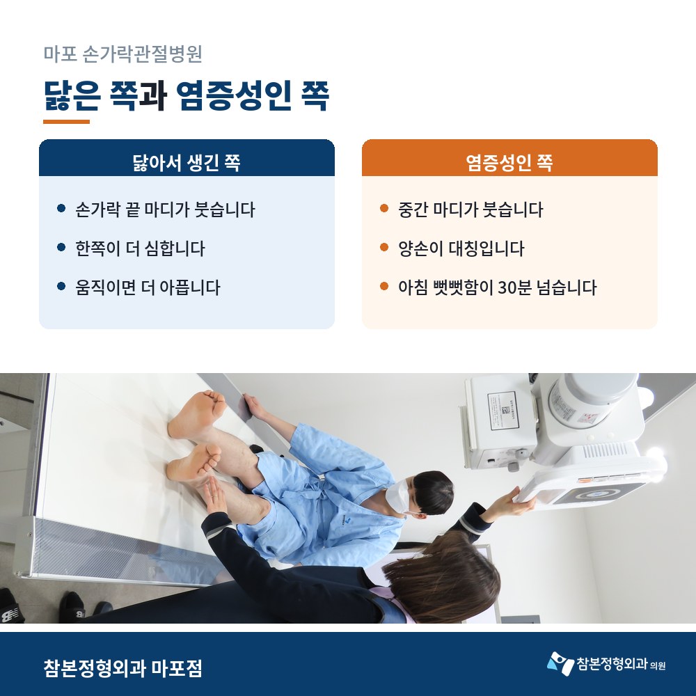 마포 손가락관절병원 손과 팔 X-ray 촬영