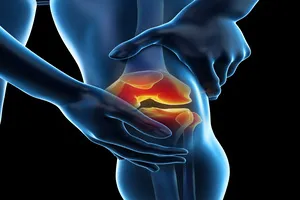 무릎-인공관절수술비용