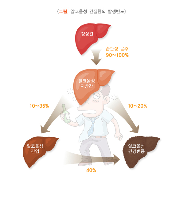 알코올성 간질환의 발생빈도