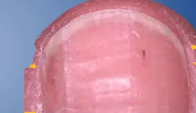 손톱에 세로줄이 생기는 이유