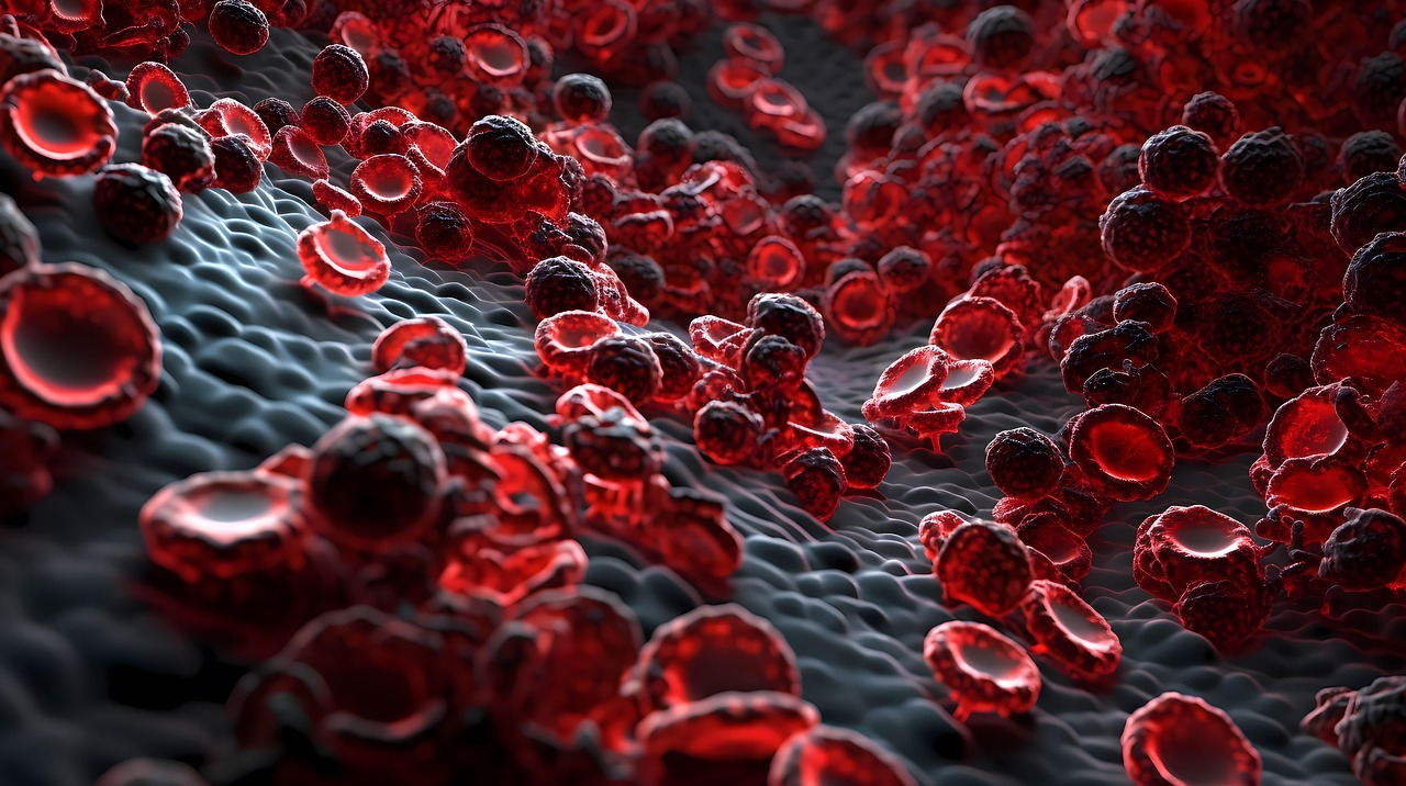 생리불순과 관련된 혈액흐름 사진