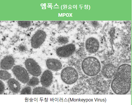 엠폭스 바이러스