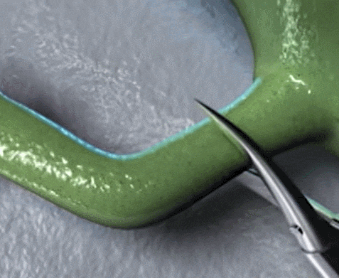 [과학기술] 도마뱀 꼬리 처럼 '조직 재생'의 가능성은