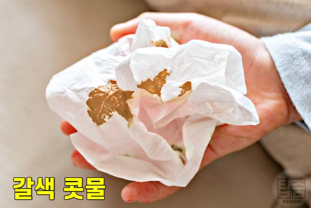 콧물 색깔별 증상,갈색 콧물 색깔로 보는 건강