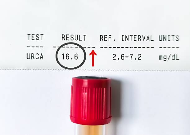 통풍 요산 정상수치란