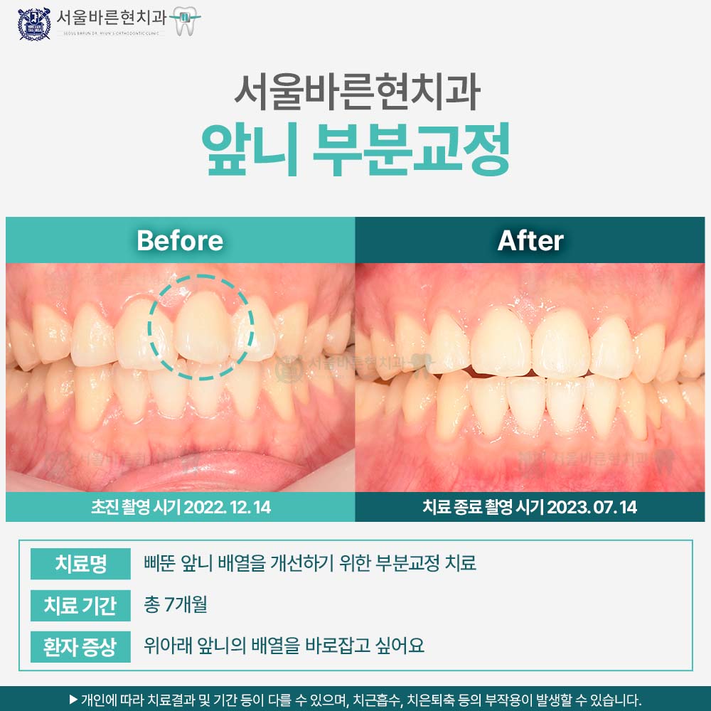 해운대치아교정