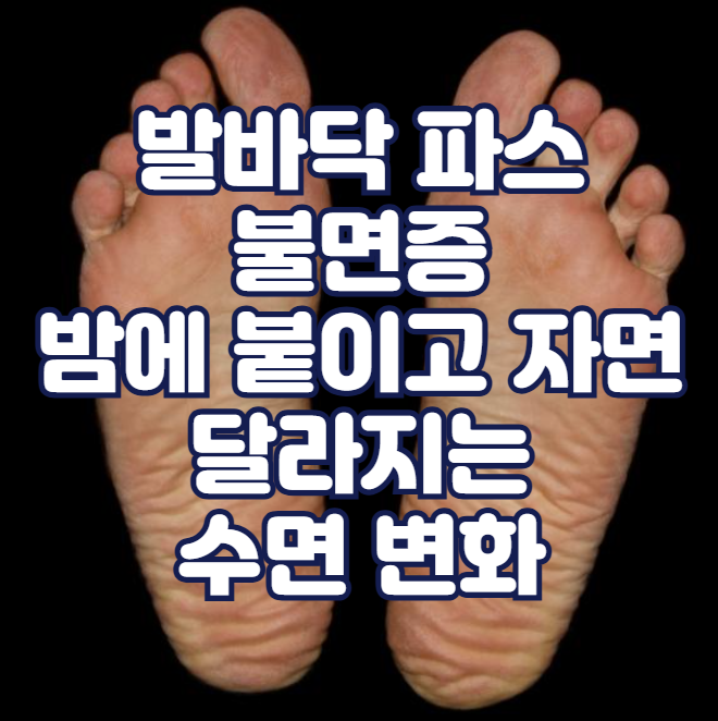 발바닥 파스 불면증, 밤에 붙이고 자면 달라지는 수면 변화​​