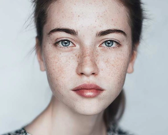 기미 없애는 방법 및 기미 제거 도움이 되는 음식 추천