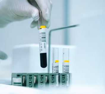 빈혈 증상 원인 치료 방법