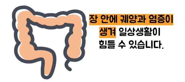 크론병이란