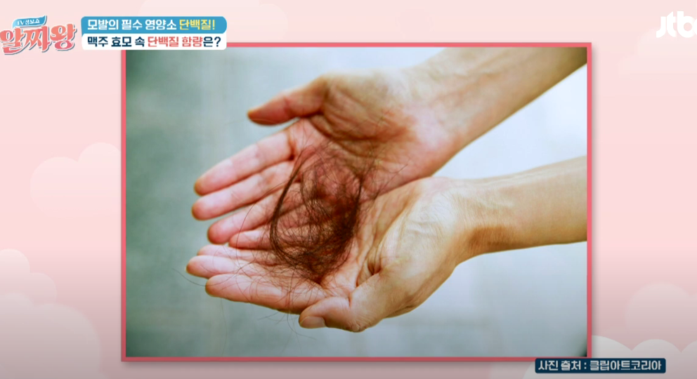 탈모 예방에 효과적인 맥주효모: 효능, 섭취 방법, 그리고 주의 사항