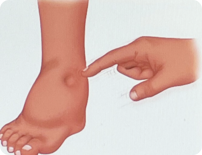 간수치가-높으면-나타나는-증상