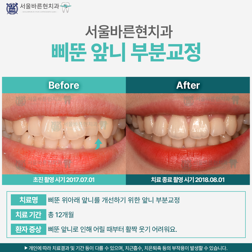 해운대교정치과