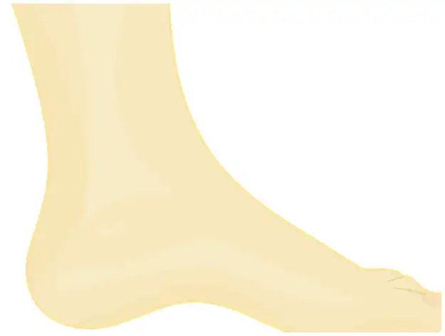 족저 근막염 신발 깔창 추천 및 선택 가이드