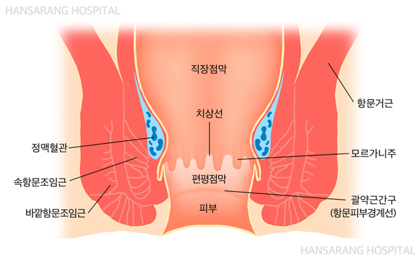 크론병-유전-완치-증상-정의