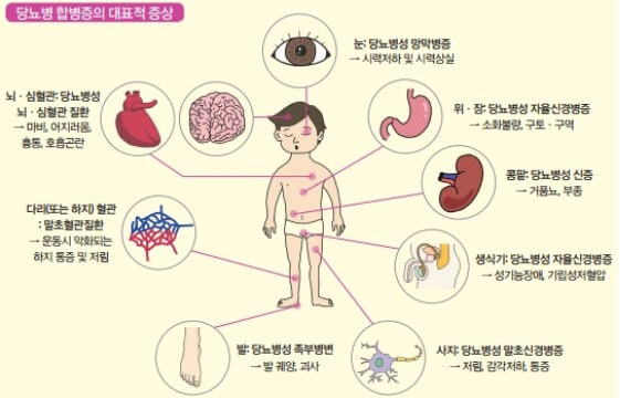 당뇨병 초기증상과 원인