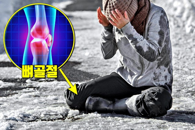 비타민d 부족증상,골다공증,골절