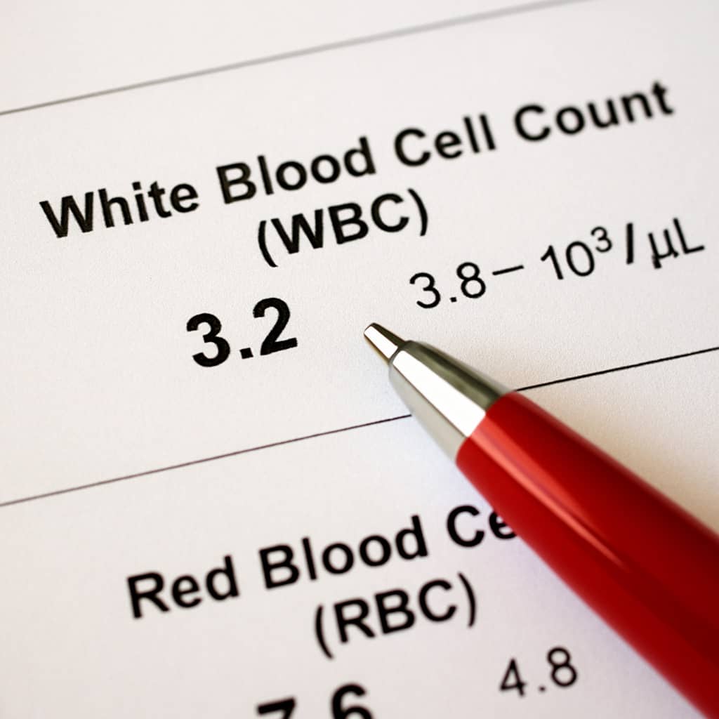 낮을 백혈구 수치