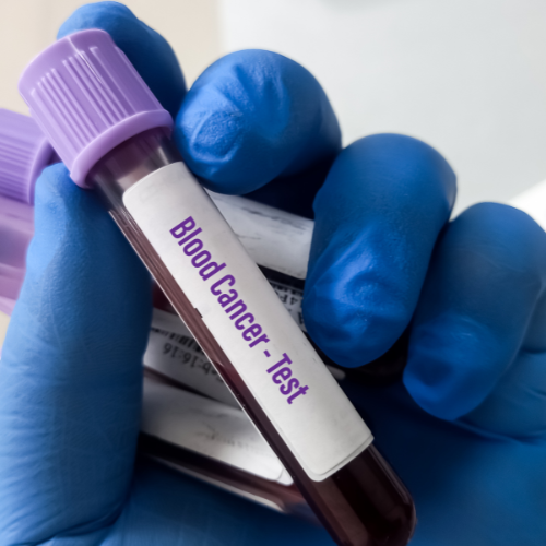 혈액암테스트