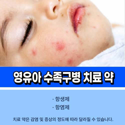 수족구병 치료 약