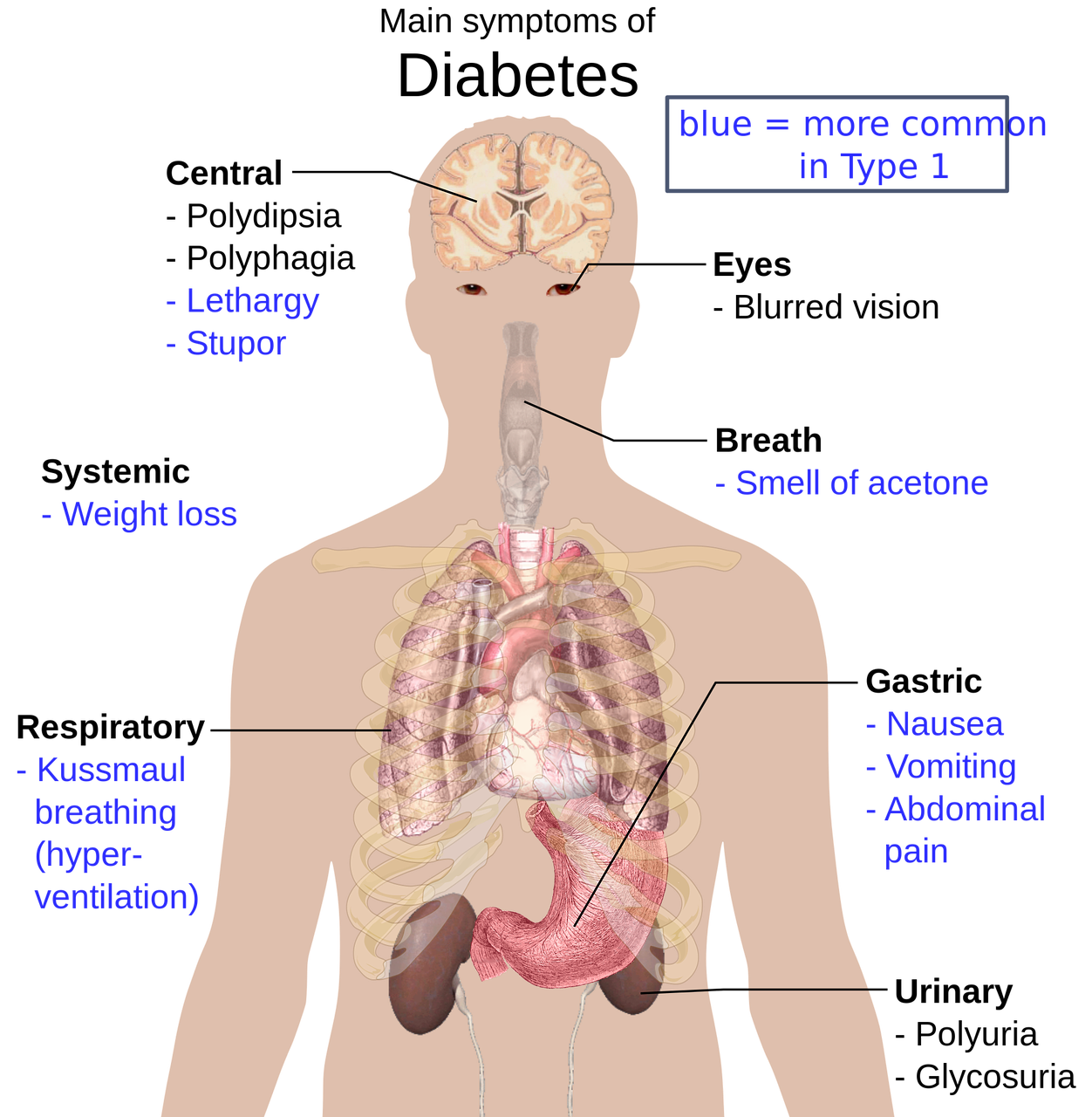 당뇨 합병증 관련 사진