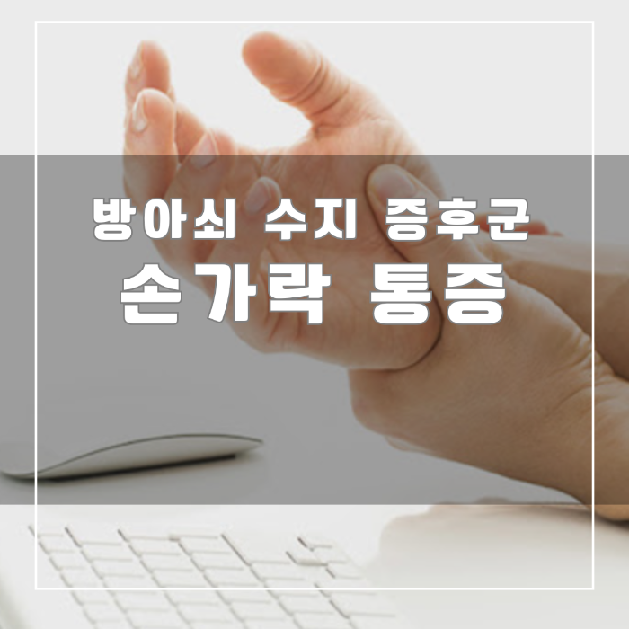방아쇠 수지 증후군