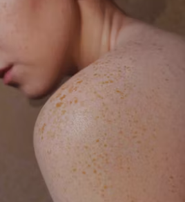 대상포진 예방접종 가격