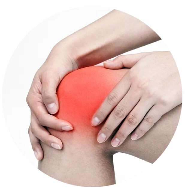 퇴행성 관절염 증상 20