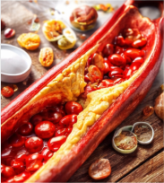 고지혈증 팩트체크