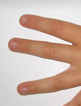 손톱이 잘 부러지는 이유와 갈라지는 이유