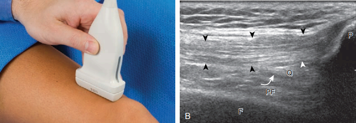 무릎 앞쪽 검사