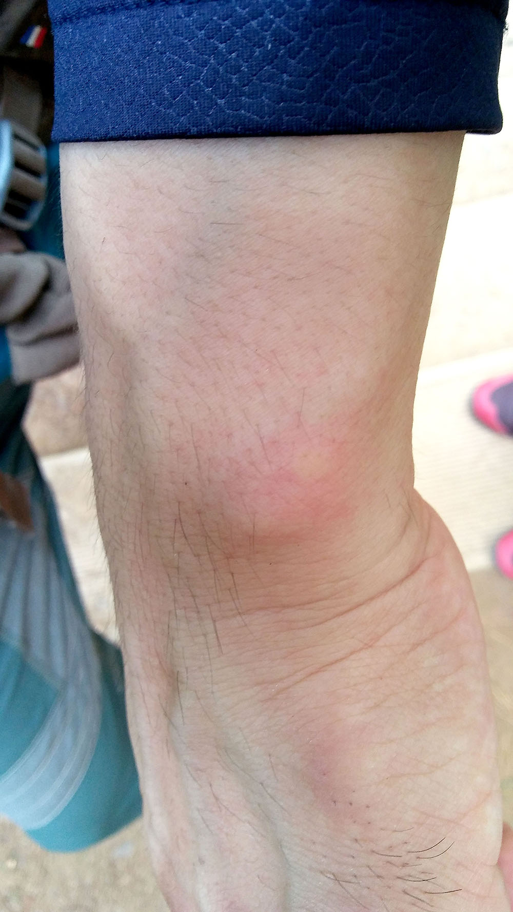 관악산&middot;삼성산 '관악산 새까만 모기'