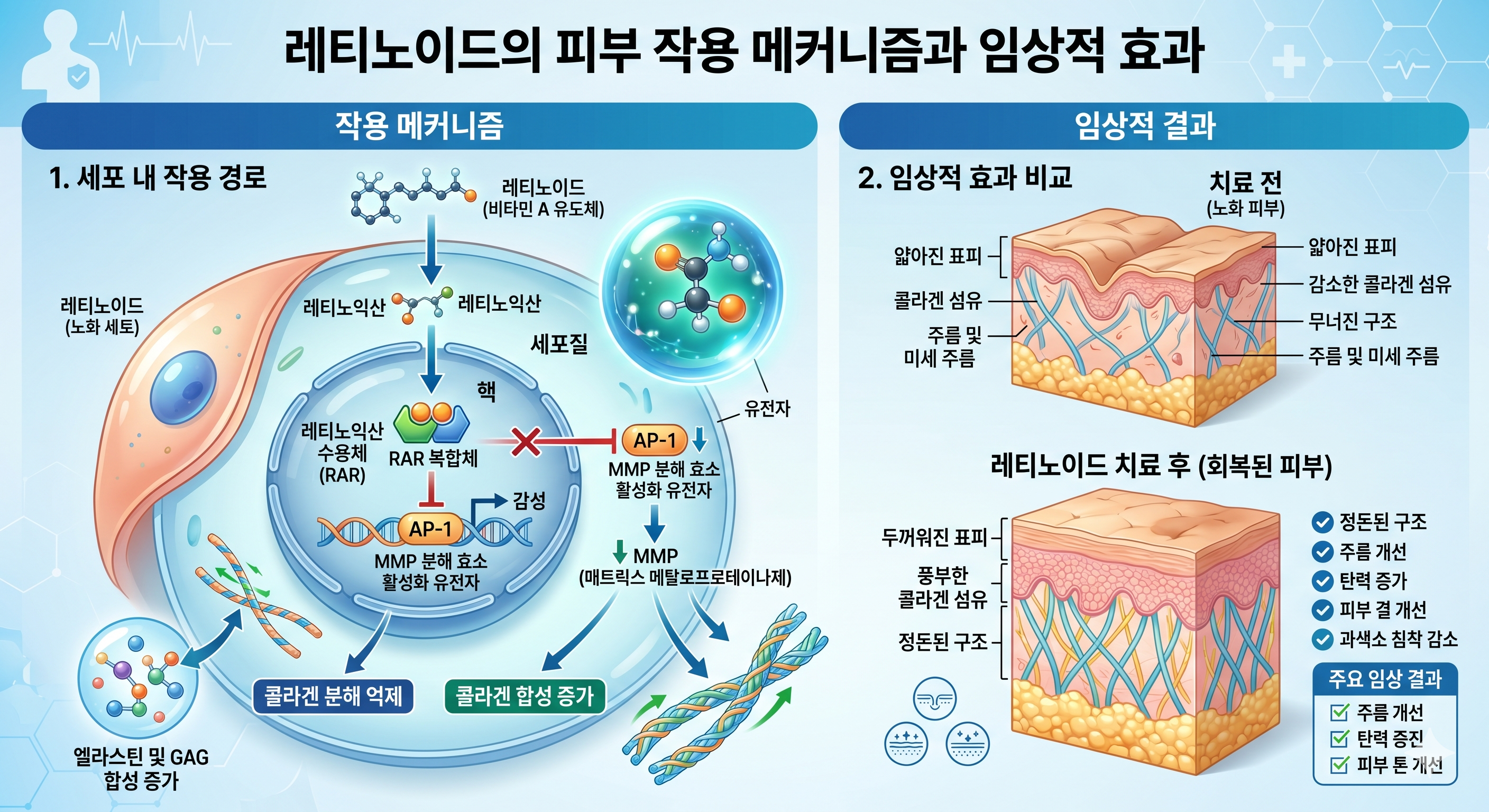 레티노이드 항노화 기전 — RAR AP-1 트랜스리프레션 MMP 억제 콜라겐 합성 증가 트레티노인 레티놀 비교