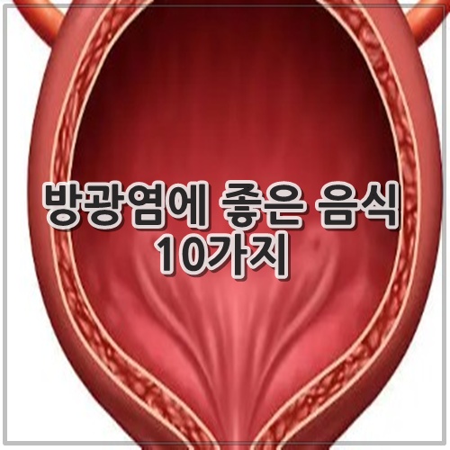 방광염에 좋은 음식 10가지