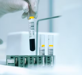 빈혈 치료방법 진단기준 합병증